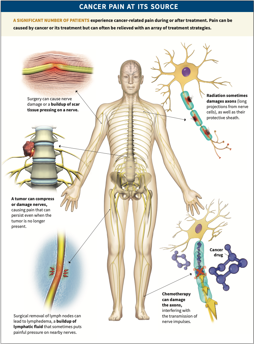 Coping With Side Effects From Cancer