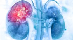 Lenvima Plus Keytruda May Become Next Standard-of-Care Treatment Option for Advanced Kidney Cancer
