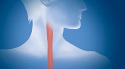 Better Quality of Life Reported with Minimally Invasive Esophageal Cancer Treatment