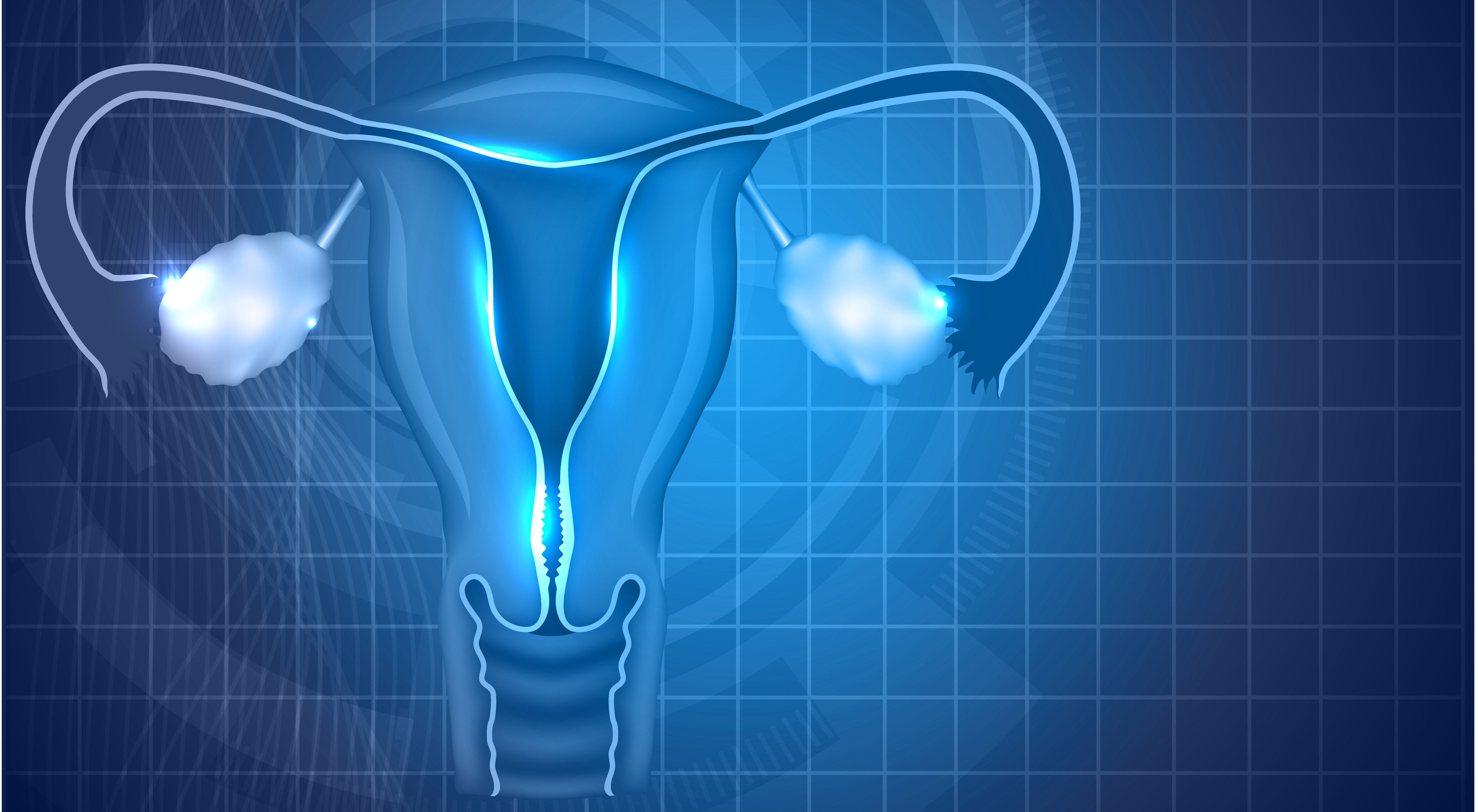 Zejula Maintenance Decreases Progression, Death Risk in Ovarian Cancer - Vimarsana News
