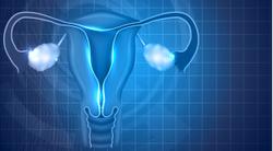 Avastin Regimen Improves Survival in Ovarian Cancer, Including Some HRD-Positive Tumors