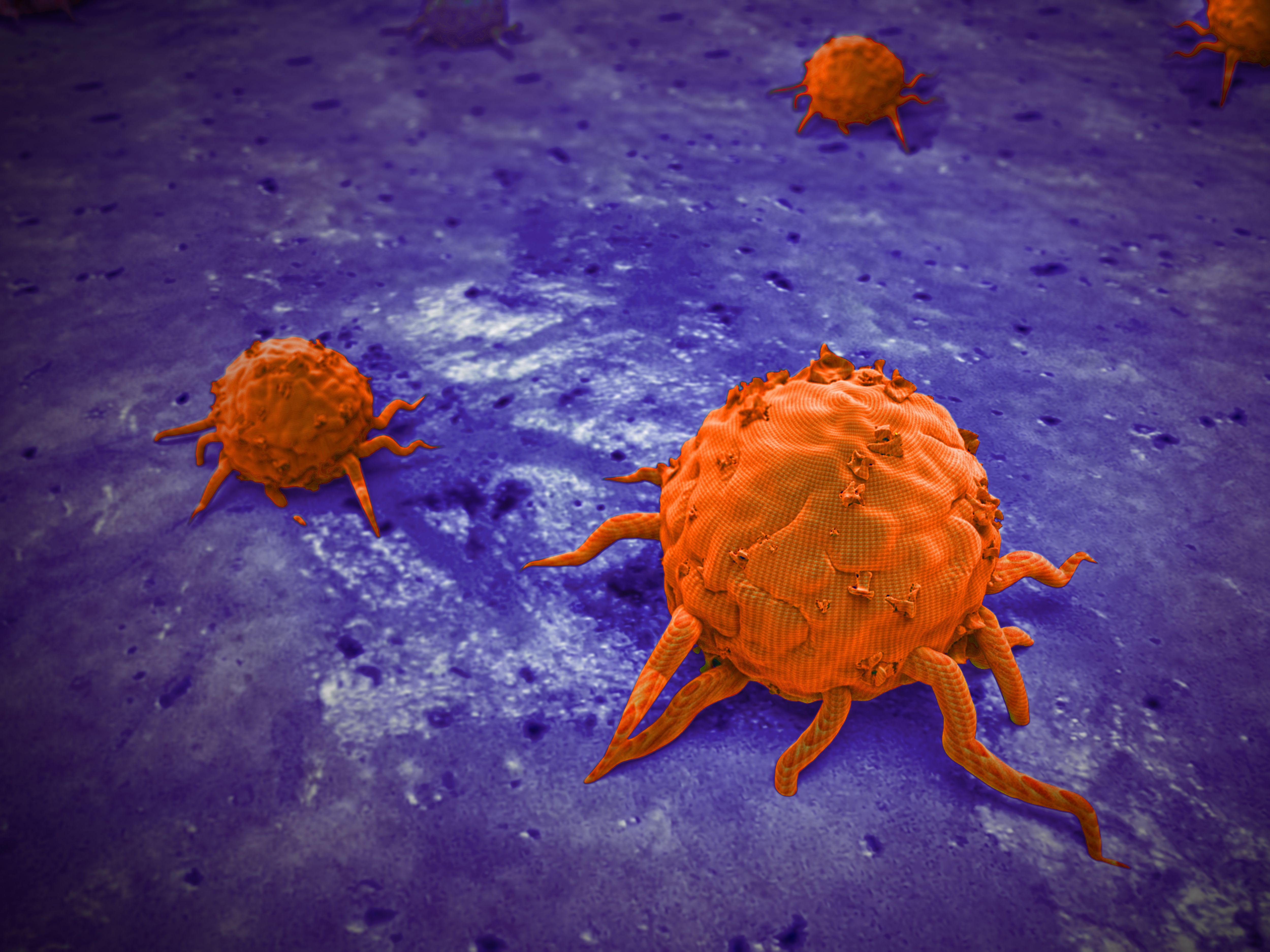 Identifying Characteristics of 'Zombie' Cancer Cells May Help Predict Relapse - Vimarsana News