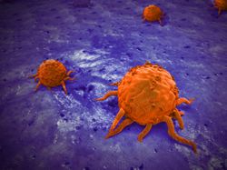 Identifying Characteristics of ‘Zombie’ Cancer Cells May Help Predict Relapse