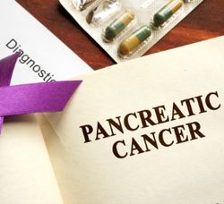 Lumakras Demonstrates Positive Results for Some Patients with KRAS G12C Pancreatic Cancer