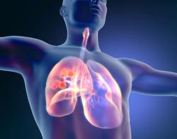 5 Lung Cancer-Related Stories to Commemorate World Lung Cancer Day