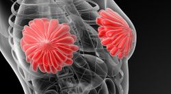 Enhertu May Further Improve Survival Versus Xeloda Regimens in HER2-Positive Breast Cancer