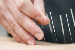 Relaxation Techniques, Acupuncture May Reduce Pain, Anxiety After Gynecologic Cancer Surgery