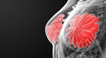 Arimidex Extends Benefit of Breast Cancer Recurrence Prevention in Postmenopausal Women