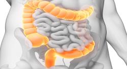 Trial for At-Home Colorectal Cancer Test Completes Enrollment of More Than 10,000 Patients
