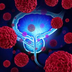 Chemoradiotherapy May Provide Long-Term Survival Benefit for Muscle-Invasive Bladder Cancer