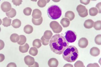 Calquence-Based Regimens Continue to Elicit Better Results Than Gazyva Plus Chemotherapy in Untreated Chronic Lymphocytic Leukemia