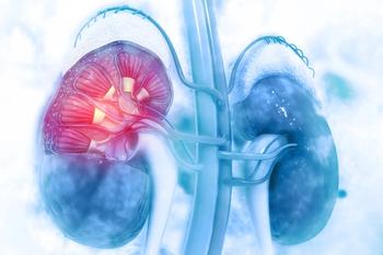 Cabometyx Significantly Prolongs Survival Over Sutent in Rare Form of Kidney Cancer