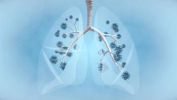 Keytruda-Cyramza Combo Bests Standard-of-Care Therapies in Previously Treated Non-Small Cell Lung Cancer 
