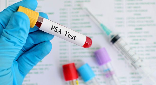 Adding Nubeqa to Therapy May Reduce PSA Levels in Metastatic Hormone-Sensitive Prostate Cancer - Vimarsana News