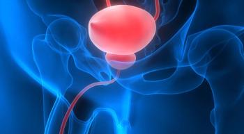 Survival Is Not Improved by Adding Tecentriq to Chemo for Metastatic Bladder Cancer