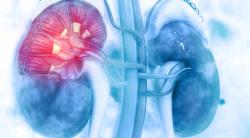 Three-Drug Regimen Is Promising Across Kidney Cancer Subtypes