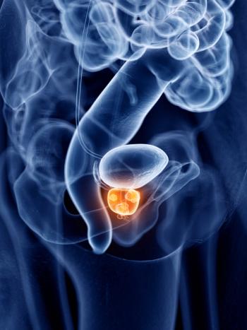 Longer Hormone Therapy After Main Treatments Delays Prostate Cancer Metastasis