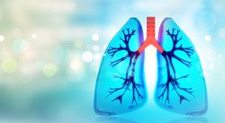 First U.S. Patient Treated in Study of Novel Drug-Chemo Combo for NSCLC Subset