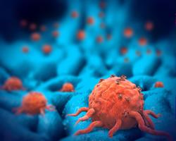 Immunotherapy Effectiveness Tied to Particular Cell Activity
