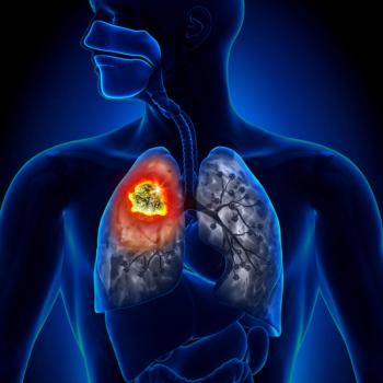 Lumakras Improves Outcomes, Quality of Life in Patients With Lung Cancer Subtype