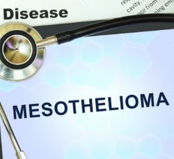 Majority of Patients with Mesothelioma Subtype Responded to Keytruda-Lenvima Combo