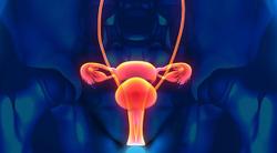 Pre- and Post-Surgical Jakafi Plus Chemo Shows Potential in Advanced Ovarian Cancer