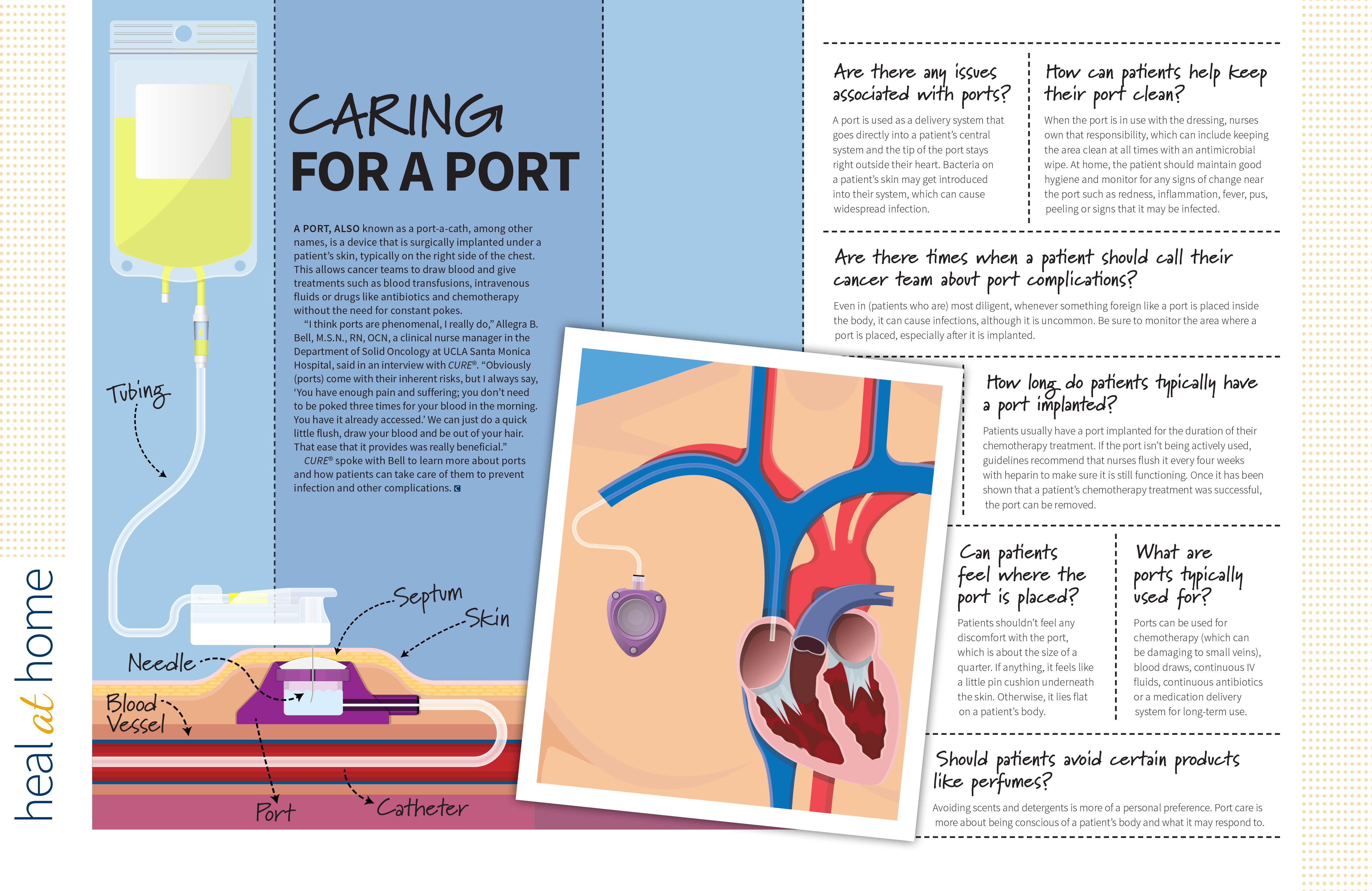 How Patients With Cancer Can Best Care For Their Chemo Port